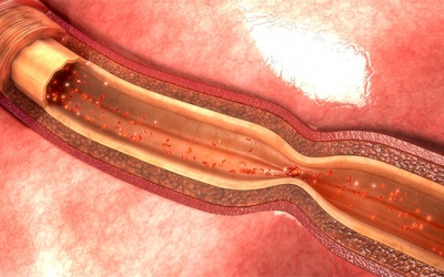 Co thắt mạch vành có nguy hiểm không, cải thiện thế nào?