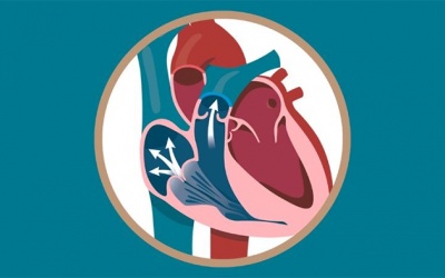 Hở van động mạch phổi có gây biến chứng gì nguy hiểm không? 