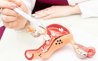 Bệnh nhân xơ tử cung có nguy hiểm không? 