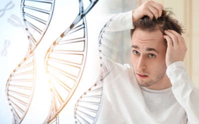 Tóc bị mỏng và thưa, nam giới nên ngừng đổ lỗi tất cả do di truyền