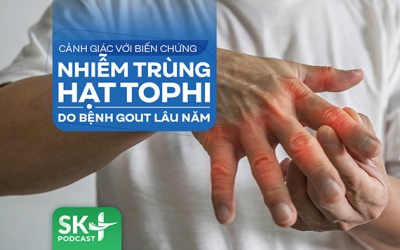 Podcast: Cảnh giác với biến chứng nhiễm trùng hạt tophi do bệnh gout lâu năm