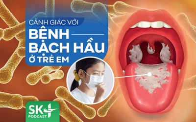 Podcast: Cảnh giác với bệnh bạch hầu ở trẻ em