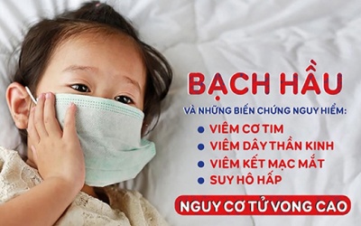 Thủ tướng yêu cầu chủ động kiểm soát, không để bùng phát bệnh bạch hầu