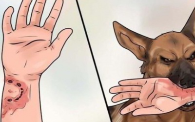 Bệnh dại: Chủ quan có thể trả giá bằng tính mạng