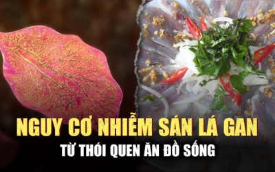 Cảnh báo nguy cơ nhiễm bệnh sán lá gan khi ăn gỏi sống