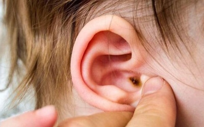  Cảnh giác biến chứng nguy hiểm của bệnh viêm tai giữa