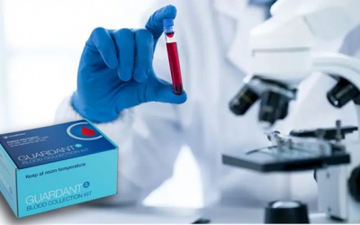 Sàng lọc ung thư đại tràng bằng xét nghiệm máu