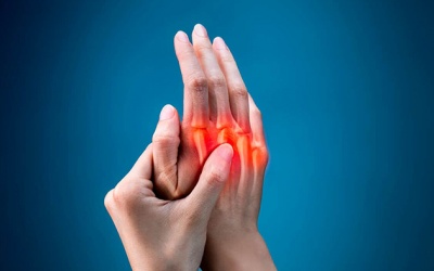 Viêm khớp vảy nến ảnh hưởng tới bàn tay ra sao?