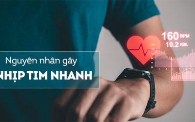 Nguyên nhân nào gây ra tình trạng tim đập nhanh?