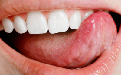 Tình trạng lưỡi nói lên điều gì về sức khoẻ của bạn?