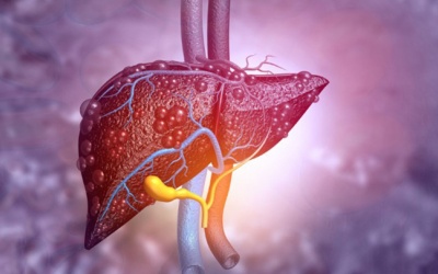 Bác sĩ chỉ ra 5 dấu hiệu cảnh báo bệnh gan nhiễm mỡ 