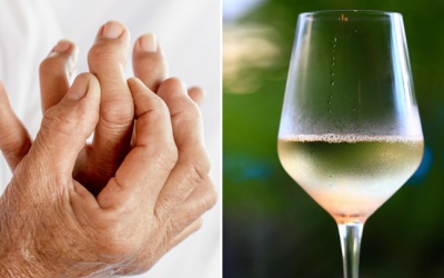 Đồ uống có cồn làm tăng nguy cơ mắc bệnh gout