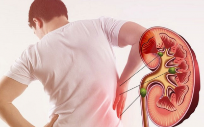 Người bị bệnh thận nên ăn gì?