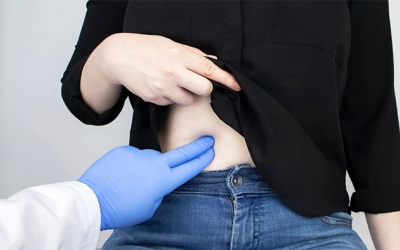 Bị sỏi túi mật 8mm, uống thuốc Tây không đỡ có nên mổ không?