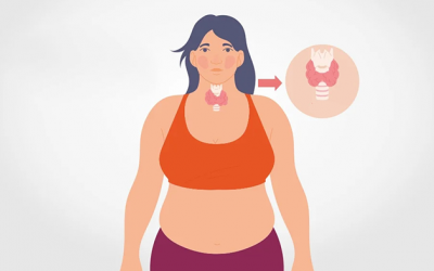 Cách khắc phục tình trạng tăng cân do suy giáp