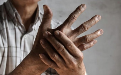 Cách làm dịu cơn đau do viêm khớp khi trời chuyển lạnh