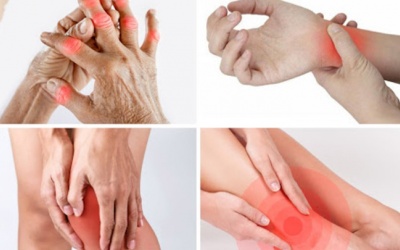 Viêm đa khớp: Tất cả những gì bạn cần biết!