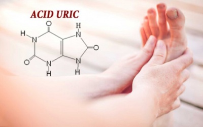 Tăng acid uric máu, làm sao để cải thiện?