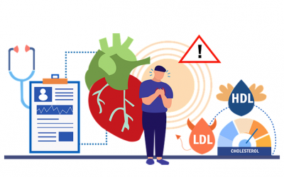 Nên làm gì khi chỉ số cholesterol trong máu tăng cao?