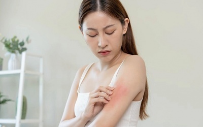 Mẹo dưỡng da mùa hanh khô từ các nguyên liệu tự nhiên