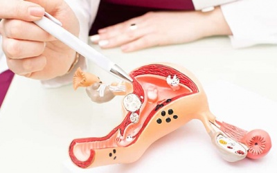 Bị nhân xơ tử cung có mang thai được không?