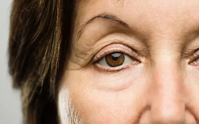 Mi mắt – vùng da dễ lão hóa nhất trên gương mặt