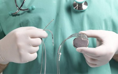 Block nhĩ thất độ 3 có cần đặt máy tạo nhịp không?