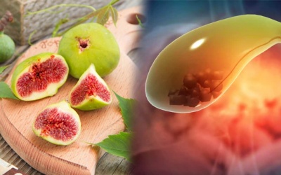 Sỏi mật 7,5mm uống nước quả sung có khỏi được không?