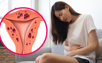 Người bệnh lạc nội mạc tử cung nên ăn gì?