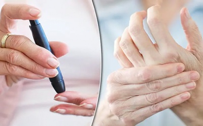 Bệnh đái tháo đường có thể gây những biến chứng nào trên da?