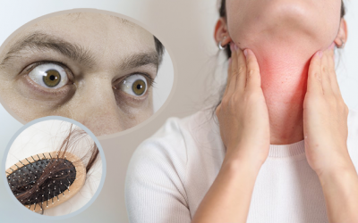 Triệu chứng của bệnh Basedow là gì, cải thiện ra sao?