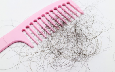 Giảm cân có thể là nguyên nhân gây rụng tóc?