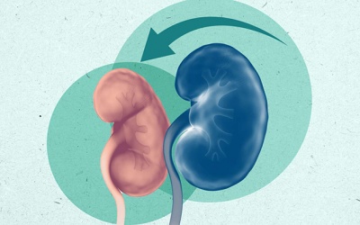 Làm thế nào để ngăn ngừa suy thận chuyển nặng?