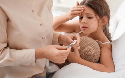 Các biến chứng bội nhiễm do thủy đậu