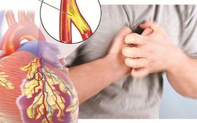 Bị bệnh mạch vành có nguy cơ biến chứng nhồi máu cơ tim không?