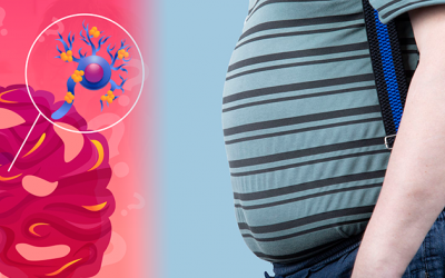 Bụng tích nhiều mỡ nội tạng, coi chừng nguy cơ mắc Alzheimer