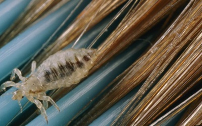 Phòng ngừa chấy cho trẻ trong mùa Đông