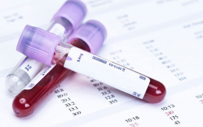 Xét nghiệm máu giúp dự đoán nguy cơ mất trí nhớ?