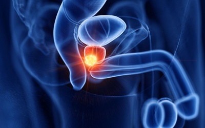 Nga đăng ký loại thuốc mới điều trị ung thư tuyến tiền liệt di căn xương