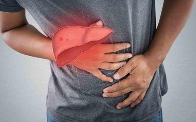 Sỏi mật có thể làm tăng đáng kể nguy cơ mắc gan nhiễm mỡ