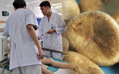 Cảnh báo nguy cơ ngộ độc Strychnin từ 'thuốc' bột chữa đau dạ dày