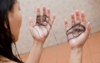 4 loại vitamin và khoáng chất giúp giảm rụng tóc trong mùa Đông