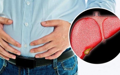 Thấy 5 dấu hiệu này, hãy cẩn thận với gan nhiễm mỡ!