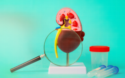 6 nguyên nhân dẫn đến tình trạng suy thận