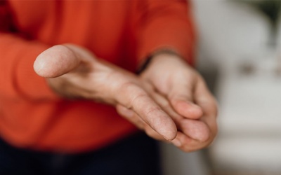 Run tay mỗi khi cáu gắt, xúc động có phải bệnh Parkinson không?