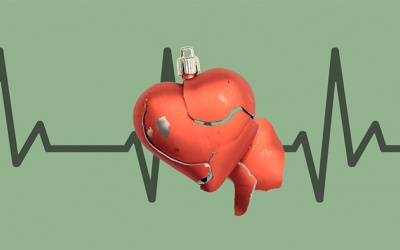 Làm sao để biết bạn đang có cơn nhồi máu cơ tim?