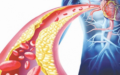 Cách phòng ngừa mỡ máu cao bằng thảo dược