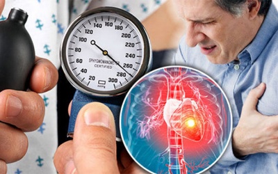 Tăng huyết áp có gây hở van 2 lá 2/4 không?