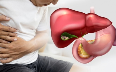 Sỏi mật kèm đái tháo đường có dùng được TPBVSK Kim Đởm Khang không?