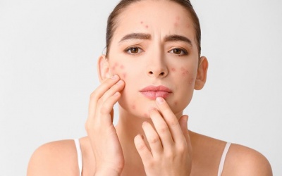 Chu trình dưỡng da sáng – tối cho làn da mụn